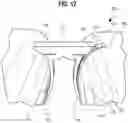 Fig. 14 - Conveyor transfer guards