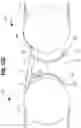 Fig. 16 - Conveyor transfer guards