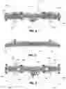 Fig. 04 - Detachable body securing mechanism and associated systems and methods