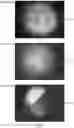 Fig. 06 - Adaptive MEMS device, codec for use with the MEMS device and method for providing diagnostic data, at run-time, on the current condition of a MEMS device