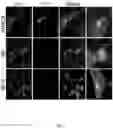 Fig. 06 - PH-DEPENDENT COMPOSITION MATTERS USEFUL FOR STUDY AND DIAGNOSIS OF ALZHEIMER'S DISEASE