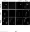 Fig. 07 - PH-DEPENDENT COMPOSITION MATTERS USEFUL FOR STUDY AND DIAGNOSIS OF ALZHEIMER'S DISEASE