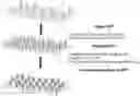Fig. 01 - CAPTURE OF MICROVESICLES FOR DIAGNOSTIC PURPOSES