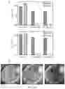 Fig. 17 - ANTIMICROBIAL AGENT
