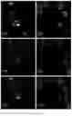 Fig. 18 - ANTIMICROBIAL AGENT