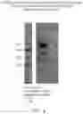 Fig. 05 - HER2-TARGETING MOLECULES COMPRISING DE-IMMUNIZED, SHIGA TOXIN A SUBUNIT SCAFFOLDS