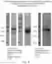 Fig. 06 - HER2-TARGETING MOLECULES COMPRISING DE-IMMUNIZED, SHIGA TOXIN A SUBUNIT SCAFFOLDS