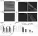 Fig. 16 - OPTOGENETIC MODULATION BY MULTI-CHARACTERISTIC OPSINS FOR VISION RESTORATION AND OTHER APPLICATIONS THEREOF