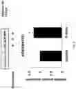 Fig. 07 - RECOMBINANT IRISIN GENE OPTIMIZED FOR EXPRESSION IN PLANTS AND METHOD FOR PRODUCING RECOMBINANT IRISIN PROTEIN USING SAME