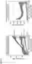 Fig. 07 - TYPE I INTERFERON-MEDIATED DISORDERS
