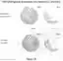 Fig. 13 - METHODS OF USING MONOCLONAL ANTIBODIES TARGETING EPITOPES OF ASPH