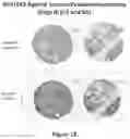 Fig. 14 - METHODS OF USING MONOCLONAL ANTIBODIES TARGETING EPITOPES OF ASPH