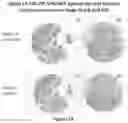 Fig. 15 - METHODS OF USING MONOCLONAL ANTIBODIES TARGETING EPITOPES OF ASPH