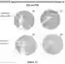 Fig. 16 - METHODS OF USING MONOCLONAL ANTIBODIES TARGETING EPITOPES OF ASPH