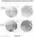Fig. 17 - METHODS OF USING MONOCLONAL ANTIBODIES TARGETING EPITOPES OF ASPH