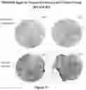 Fig. 18 - METHODS OF USING MONOCLONAL ANTIBODIES TARGETING EPITOPES OF ASPH