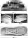 Fig. 11 - Methods of manufacturing articles utilizing foam particles
