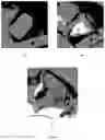 Fig. 07 - Biodegradable composition