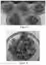 Fig. 07 - Melt-flowable extracts from biomass as a selective additive for agglomerated biomass with binding and moisture resistance properties