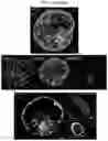 Fig. 07 - INDUCED STEM CELLS