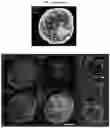 Fig. 08 - INDUCED STEM CELLS