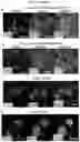 Fig. 46 - INDUCED STEM CELLS