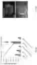 Fig. 29 - Methods, compositions, and kits for producing beige adipocytes and treating metabolic disorders