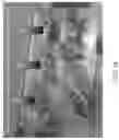 Fig. 56 - Methods, compositions, and kits for producing beige adipocytes and treating metabolic disorders