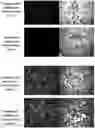Fig. 01 - THREE-DIMENSIONAL CULTURE METHOD FOR LARGE-SCALE PREPARATION OF STEM CELLS