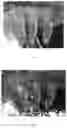 Fig. 04 - THREE-DIMENSIONAL CULTURE METHOD FOR LARGE-SCALE PREPARATION OF STEM CELLS