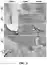 Fig. 40 - Mammalian somatic cell with modified RNA encoding reprogramming factors