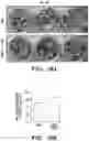 Fig. 41 - Mammalian somatic cell with modified RNA encoding reprogramming factors