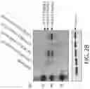 Fig. 05 - GM3 SYNTHASE VECTORS AND USES THEREOF