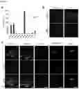 Fig. 02 - DUAL INHIBITION OF PLEXIN-B1 AND PLEXIN-B2
