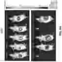 Fig. 10 - Viral vector constructs for delivery of nucleic acids encoding cytokines and uses thereof for treating cancer