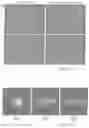 Fig. 87 - INSTRUMENT AND SYSTEM FOR RAPID MICROORGANISM IDENTIFICATION AND ANTIMICROBIAL AGENT SUSCEPTIBILITY TESTING