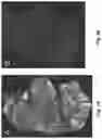 Fig. 06 - DNA-antigen exchange and amplification