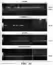 Fig. 22 - METHODS OF PREPARING MICROVESICLE MICRORNAS FROM BODILY FLUIDS