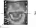 Fig. 09 - LOW FRICTION INFRARED-EMITTING FIBER AND METHODS OF MAKING THE SAME