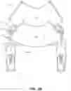 Fig. 06 - Urine catcher for a urinal