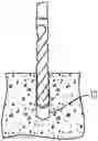 Fig. 01 - UNDERCUT ANCHOR