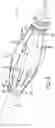 Fig. 05 - Multi-diameter thrust cups