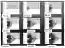 Fig. 12 - High energy fracking device for focused shock wave generation for oil and gas recovery applications