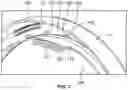 Fig. 08 - Roller bearing seal assembly
