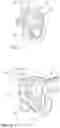 Fig. 04 - Rack steering system and motor vehicle having such a rack steering system
