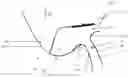 Fig. 06 - Sealing ring and use thereof