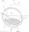 Fig. 04 - Flow control seals
