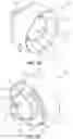 Fig. 05 - Suppressor