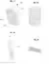 Fig. 11 - Holster attachment