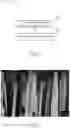Fig. 05 - Tungsten trioxide/silicon nanocomposite structure, method for manufacturing the same and gas sensing device having the same